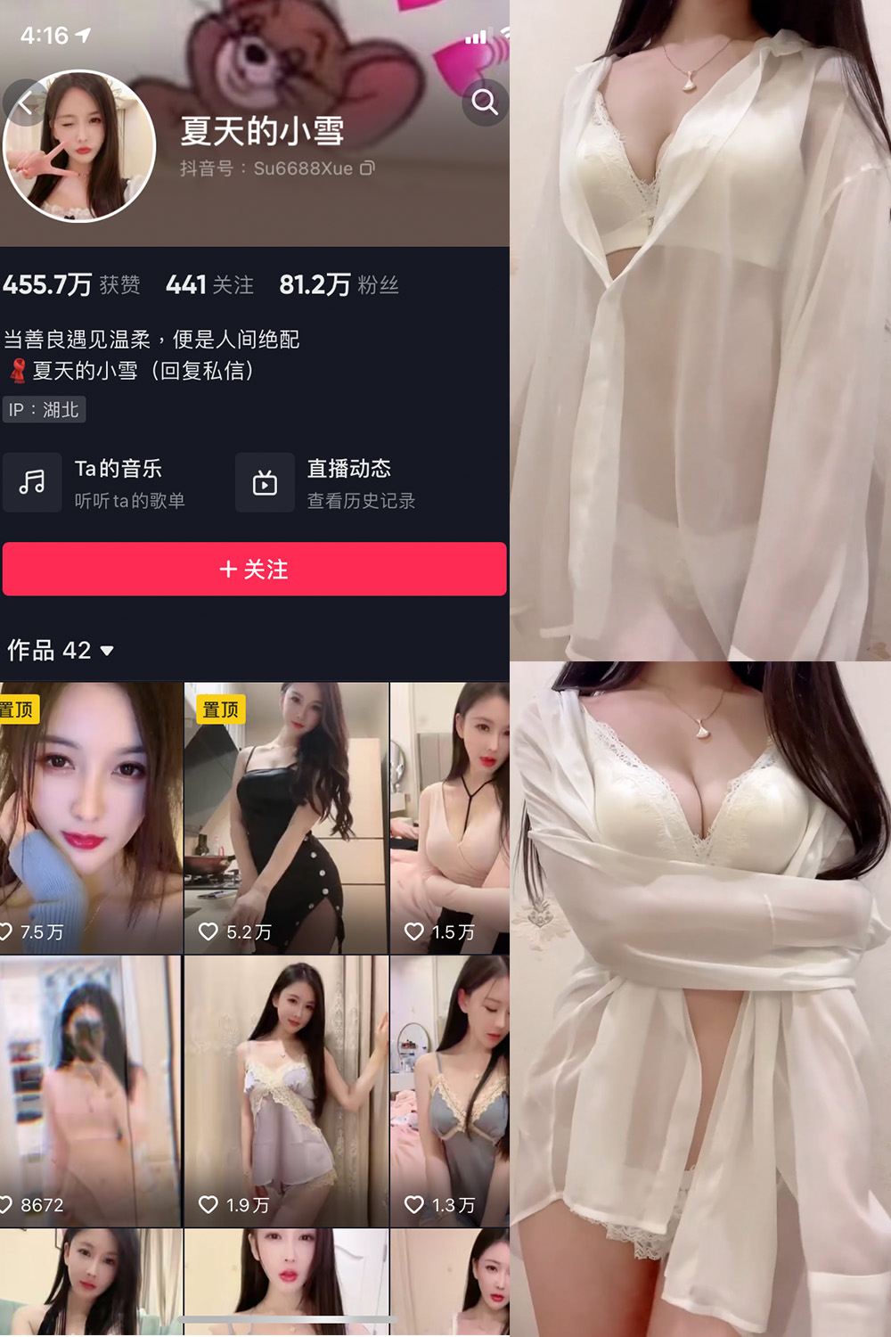 夏天的小雪 微密圈 嘉宾专享 NO.011期 最新至：2023.8.11