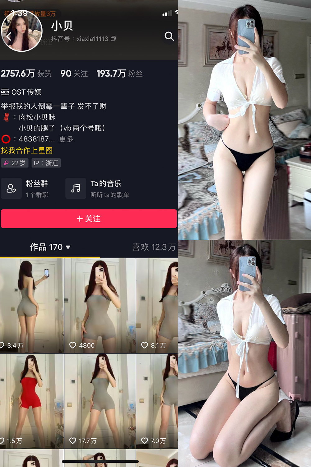 小贝 VIP 微密圈 NO.005期